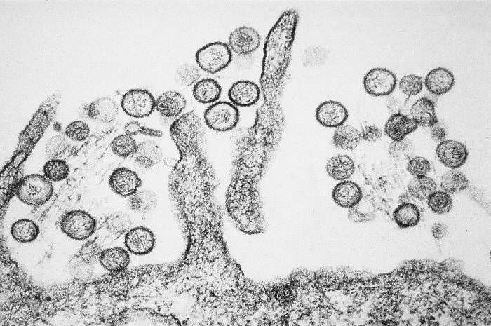 Le virus de Schmallenberg appartient à la famille des Orthobunyavirus. © Centers for Disease Control and Prevention