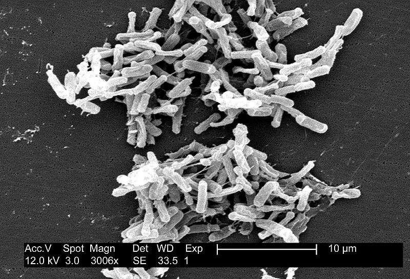 Les bactéries du genre Clostridium sont anaérobies. Elles sont très résistantes, car elles sont capables de former des spores. Clostridium perfringens est responsable de nombreuses infections alimentaires. © Marco Tolo, Wikimedia Commons, cc by sa 3.0
