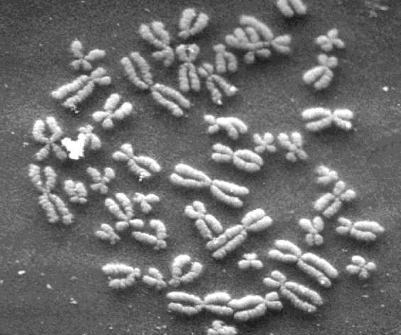 Les chromosomes du génome humain Les chromosomes du génome humain
