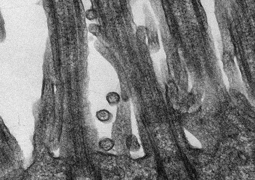 Des coronavirus SARS-CoV-2, responsables de la maladie Covid-19, accrochés aux cellules épithéliales respiratoires humaines. © M.Rosa-Calatraval, O.Terrier, A.Pizzorno, E.Errazuriz-cerda