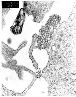 Le virus de la dengue, ces petites billes rondes et sombres vues au microscope électronique à transmission, est très répandu. Affectant jusqu'à 100 millions de personnes à travers le monde chaque année, il en tuerait aux alentours de 25.000. © Centers for Disease Control and Prevention, Wikipédia, DP