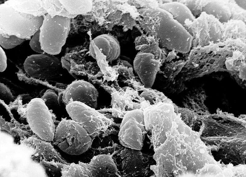 La bactérie Yersinia pestis, agent de la peste. © DR