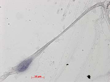 Un des spermatozoïdes humains développés in vitro à partir de spermatogonies prélevées chez un individu. © M.H.Perrard, CNRS, Kallistem