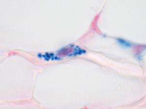 Les points bleus sont des petites billes de fer contenues au sein d'une seule et même cellule (le noyau, coloré en rose, est visible au centre). Ces cellules seraient en réalité des macrophages et non des neurones. © Treiber et al. 2012, Nature