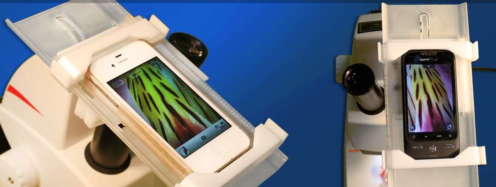 SkyLight greffe un microscope sur un smartphone