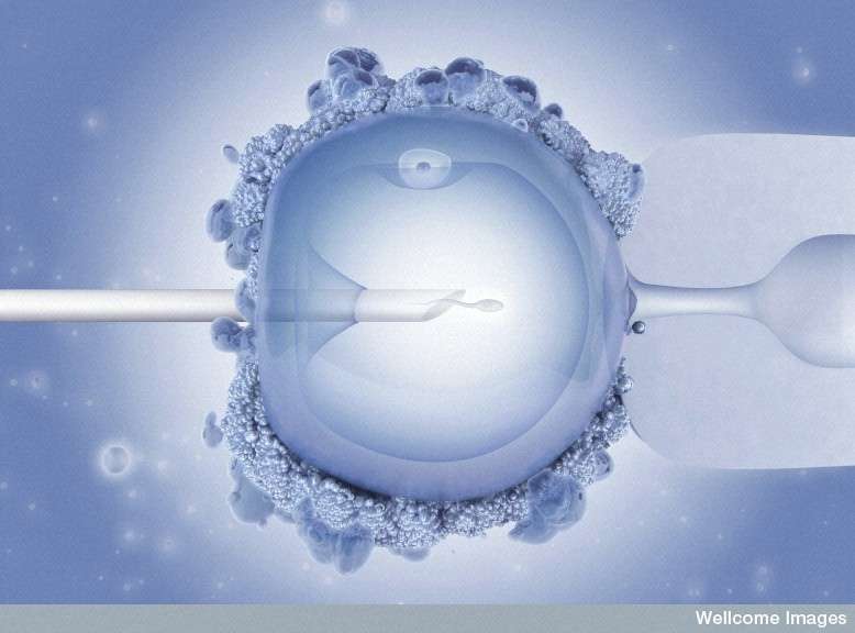 L'ICSI, ou injection intracytoplasmique de spermatozoïdes, a été mise au point il y a une vingtaine d'années par des chercheurs belges. Elle permet d'améliorer très nettement la fécondation in vitro (Fiv) car elle est rendue possible à l'aide d'un seul spermatozoïde. © Maurizio de Angelis, Wellcome Images, Flickr, cc by nc nd 2.0