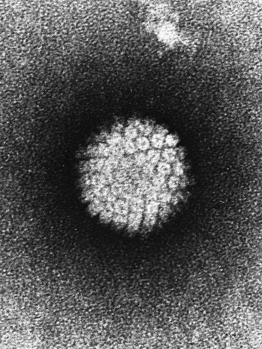 Le virus HPV (ici en microscopie électronique) se transmet par voie sexuelle et contamine plus 6.000 personnes chaque année. © Public domain
