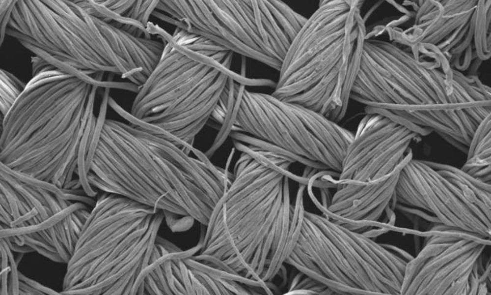 Voici une vue agrandie 200 fois de la fibre de coton recouverte d’une nanostructure à base d’argent ou de cuivre lui permettant d’éliminer les molécules organiques qui composent une tâche. © RMIT