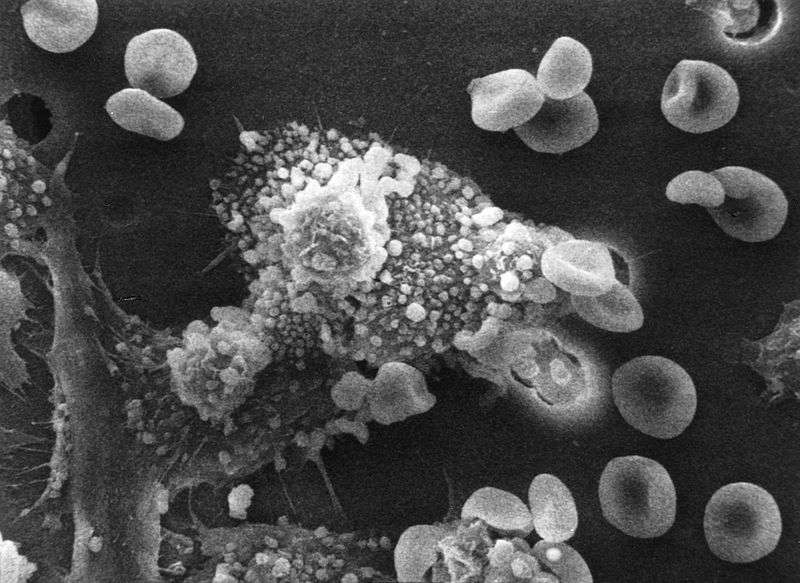 Image de microscopie électronique de macrophages attaquant une cellule cancéreuse. Les macrophages sont des cellules immunitaires qui ont un rôle dans la phagocytose, c’est-à-dire dans l’ingestion non spécifique de molécules étrangères ou cancéreuses. Les macrophages ne se divisent pas. © Dr Raowf Guirguif, Wikimedia Commons, cc by sa 3.0