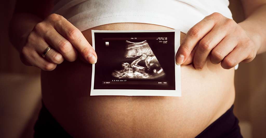La deuxième échographie, l'échographie morphologique, permet de connaître le sexe du bébé. © AndreyUG - Shutterstock
