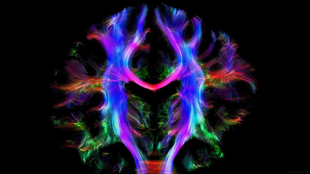 Des connexions dans le cerveau Des connexions dans le cerveau