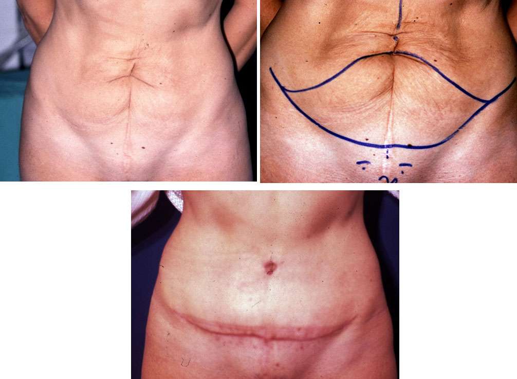 comment perdre la graisse du ventre et développer des abdominaux comment perdre la graisse du ventre et développer des abdominaux