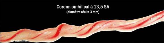 Cordon ombilical à 13,5 semaines d’aménorrhée. Les deux artères et la veine ombilicales, qui assurent la circulation placentaire, sont enveloppées d’un tissu gélatineux (gelée de Wharton). © aly-abbara.com