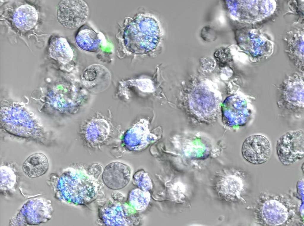 En vert sur cette image, des cellules immunitaires ayant ingéré des nanoparticules de soie d’araignée. Les endosomes – la partie de la cellule dans laquelle les nanoparticules relâchent le vaccin – apparaissent en bleu. © Carole Bourquin, UNIGE