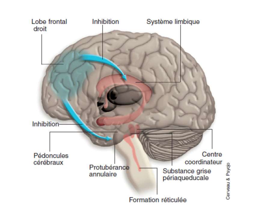 Le rire est normalement contrôlé par un centre coordinateur relié à diverses zones cérébrales, à savoir le système limbique pour les aspects émotionnels de l’hilarité, et la protubérance annulaire, la formation réticulée et la substance grise périaqueducale pour les aspects moteurs (cris et secousses musculaires). Ces zones du rire sont inhibées par le lobe frontal droit : si ce dernier est lésé, elles s’activent de façon intempestive, suscitant le « rire pathologique ». © Cerveau & Psycho