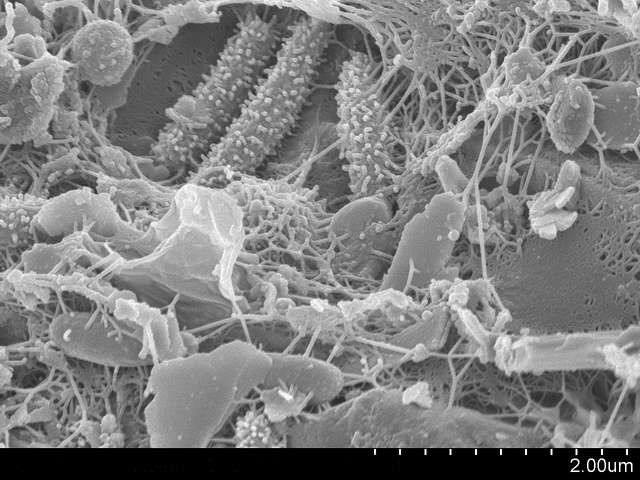 Le système digestif abrite un grand nombre de micro-organismes qui forment des communautés appelées biofilms (ici sur un grain de sable). Une étude montre qu'en changeant cette flore intestinale, on perturbe les fonctions cérébrales. La barre d’échelle représente deux micromètres. © adonofrio, Flickr, cc by 2.0
