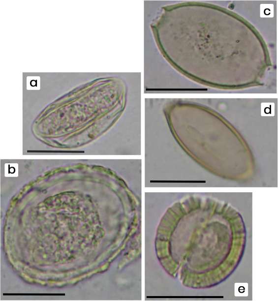 Les œufs de plusieurs espèces parasites de l'être humain ont été trouvés au niveau des toilettes datant du VIIe siècle avant J.-C. à Jérusalem. (a) Enterobius vermicularis ; (b) Ascaris lumbricoides ; (c) Trichuris suis ; (d) Trichuris trichiura ; (e) Taenia sp. Barre d'échelle : 25 µm. © Photographies prises par Eitan Kremer et Sasha Flit, publiées dans l'article de Dafna Langgut, 2021