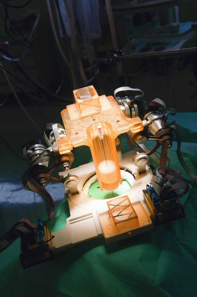 Les robots guidés par scanner, l'avenir de la chirurgie ? Les robots guidés par scanner, l'avenir de la chirurgie ?