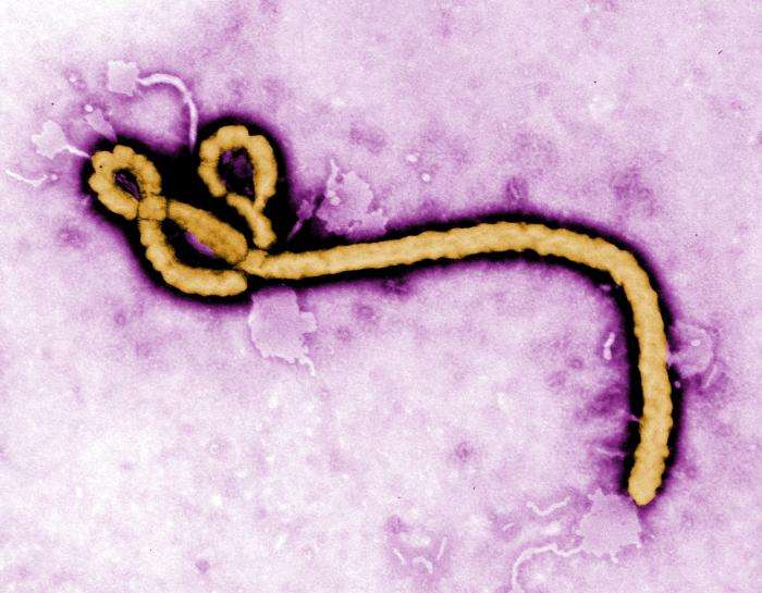 Le virus Ebola, de la famille des filovirus, peut se montrer extrêmement mortel. Certaines souches tuent 90 % des personnes qu'elles infectent. Il est tellement dangereux que bien souvent il cause la mort de son hôte avant d'avoir pu contaminer un autre organisme, ce qui en fait un de ses points faibles... © Frederick Murphy, CDC, DP 