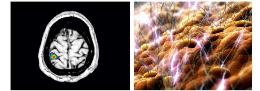 Photo L Action Des Caresses Sur Le Cerveau Par Irm
