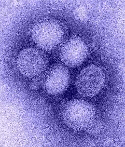 Definition Virus De La Grippe Virus Influenza Myxovirus Influenzae Futura Sante