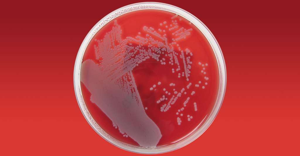 Staphylococcus aureus. © Nathan, CC BY 2.0
