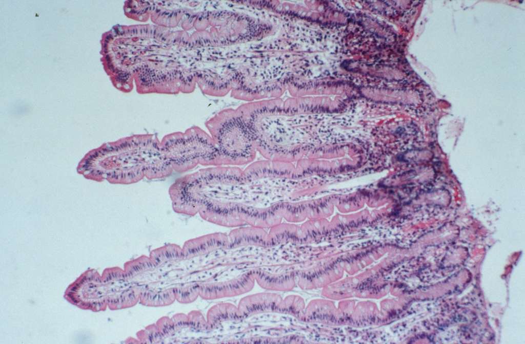 Coupe histologique (x 160). Ces villosités intestinales de 0,5 mm de diamètre tapissent toute la muqueuse de l’intestin grêle et multiplient la surface d’absorption par cinquante. © Inserm/Roger Assan