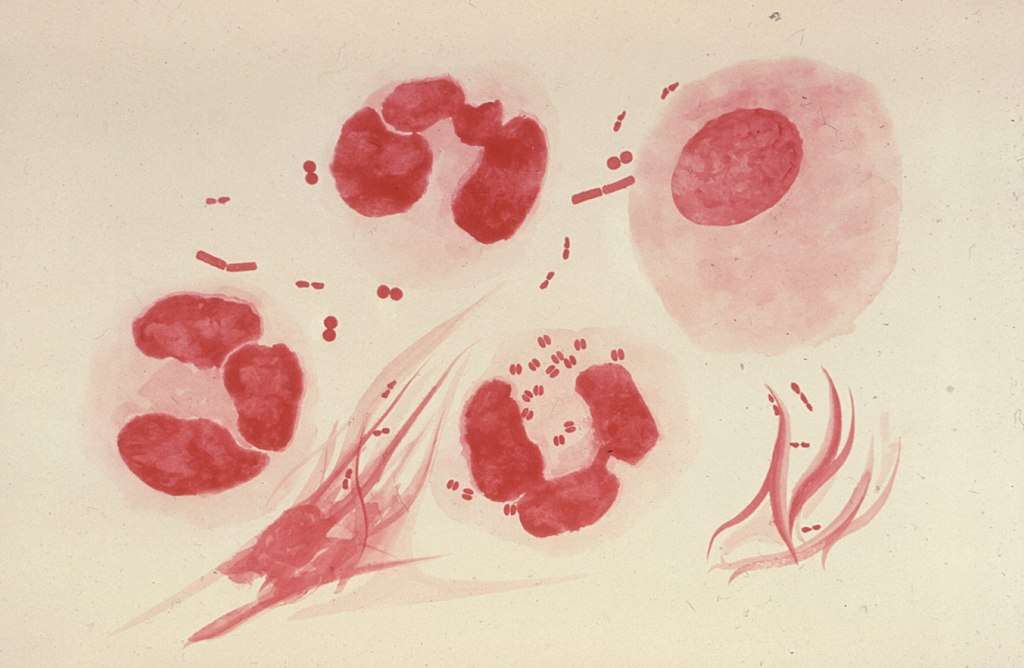 Des Neisseria gonorrhoeae infectant des neutrophiles (en bas au centre). On distingue bien leur forme particulière dite en « grain de café ». © CDC, Dr. Norman Jacobs
