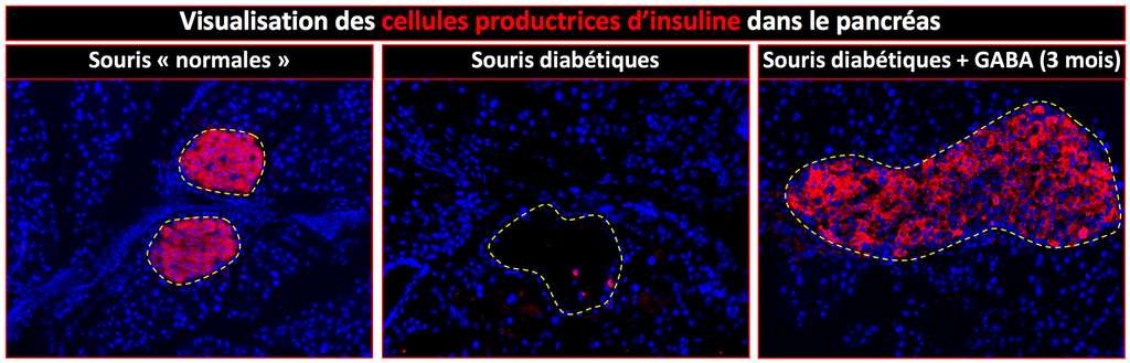 Les cellules du pancréas qui fabriquent l’insuline sont régénérées chez les souris complémentées en Gaba (à droite). © Inserm
