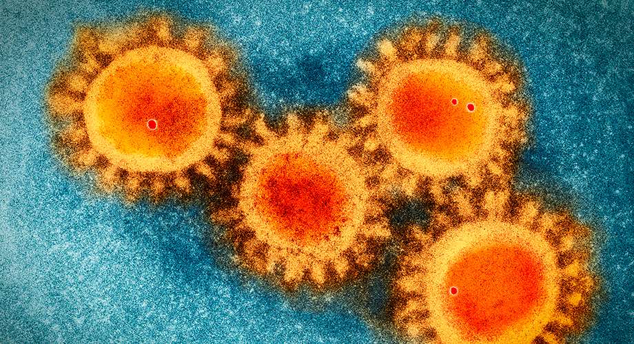 Le coronavirus SARS-CoV-2 vu au microscope électronique. © Scripps