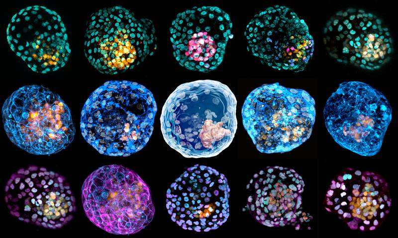 Les différents blastoïdes obtenus par l'équipe de la Monash University. Chaque couleur représente une population cellulaire distincte. © Monash University