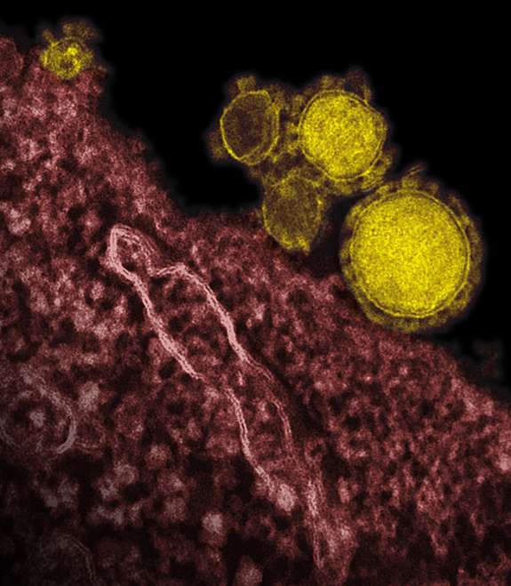 En jaune, on peut voir le coronavirus MERS-CoV, un genre de virus qui se caractérise par des contours faisant songer à une couronne. Au 2 juin, il a déjà tué 57 % des personnes qu'il a infectées, une mortalité très élevée pour un pathogène. © NIAID, RML, DP