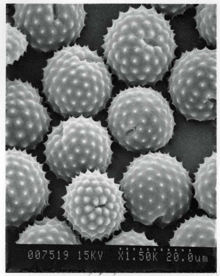 Des grains de pollen observés au microscopique électronique. © Lewis Ziska