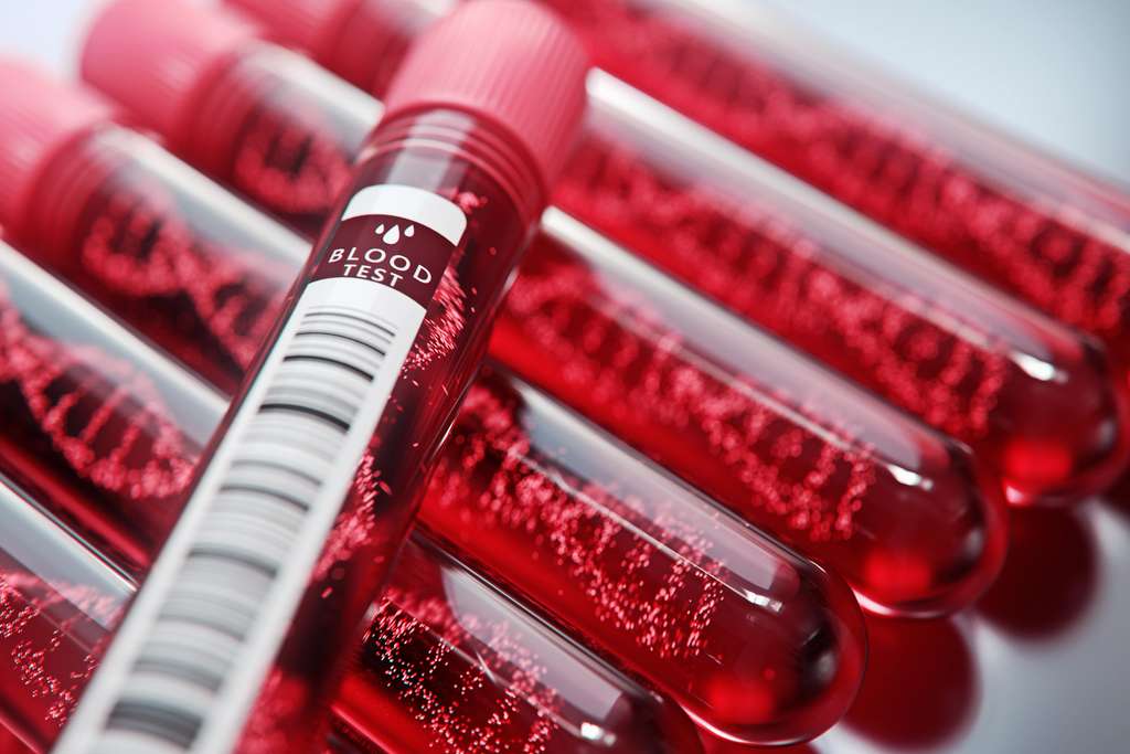 Une simple prise de sang permet de doser la quantité d'ARN viral.© Connect world, Adobe Stock