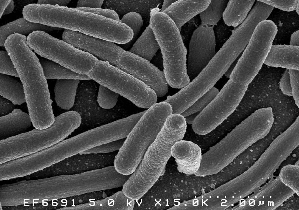 Les bactéries E. coli sont des bacilles mesurant généralement 1 à 2 µm de long. © Elapied, Wikimdia Commons, DP