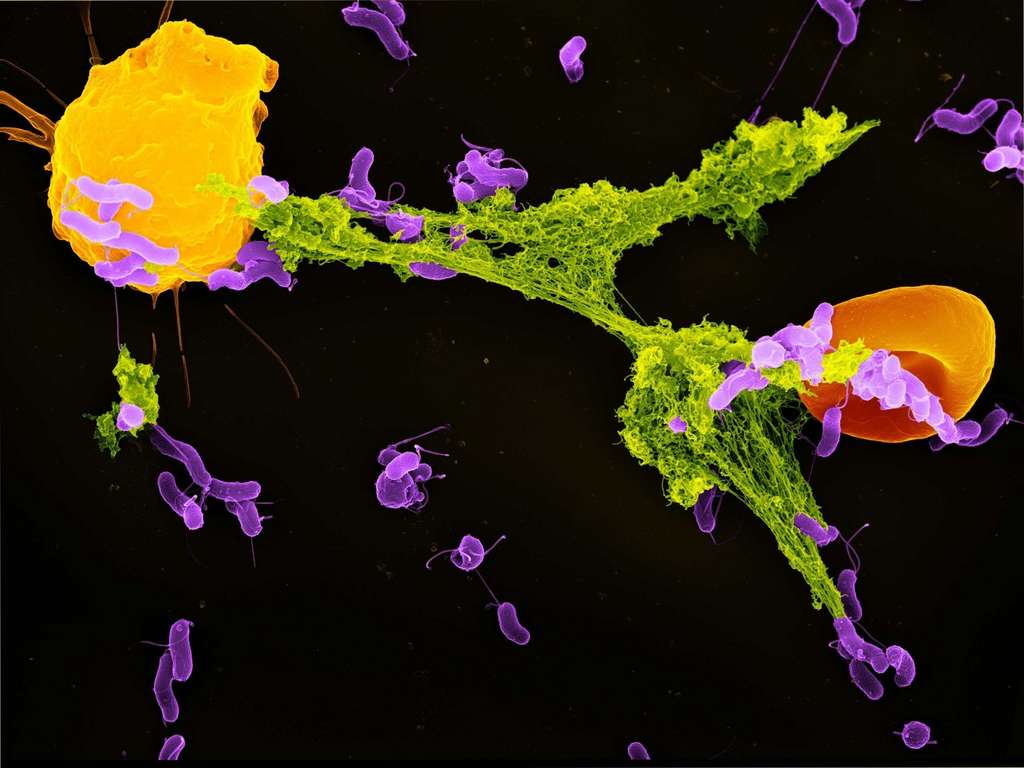 Un neutrophile (en jaune) qui déploie son NET (en vert) pour attraper des bactéries (en violet). © CHDENK, Wikimedia Commons