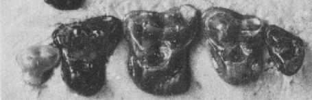 Dents fossiles d'Adapisorex. © Toute reproduction et utilisation interdites