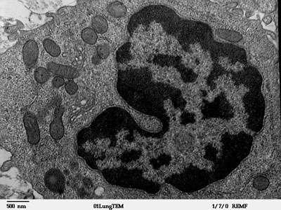 Un macrophage d’alvéole pulmonaire de mammifère vu au microscope électronique à transmission. La durée de vie des macrophages peut atteindre plusieurs années. © DP