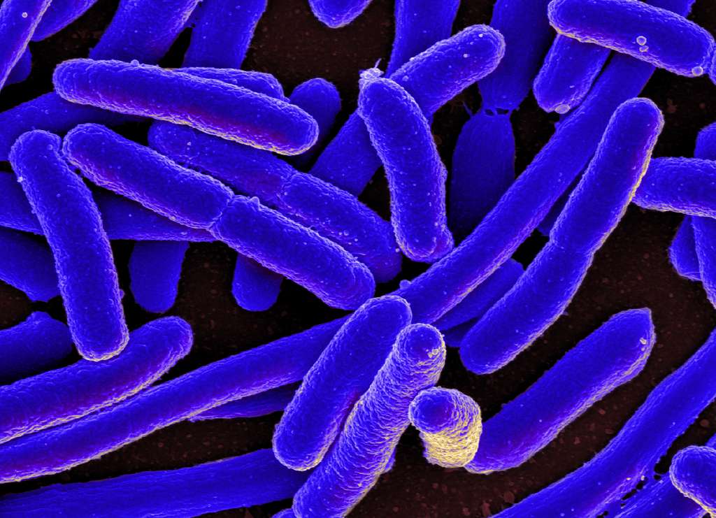 Des bactéries E. coli vues au microscope électronique. © NIAID