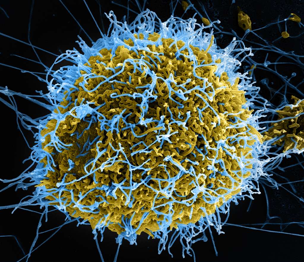 Le virus Ébola appartient à la famille des filovirus, comme son terrible cousin, le virus Marburg. Ces deux virus à ARN simple comptent parmi les pathogènes les plus dangereux qui existent pour l’Homme. © Frederick Murphy, CDC, DP