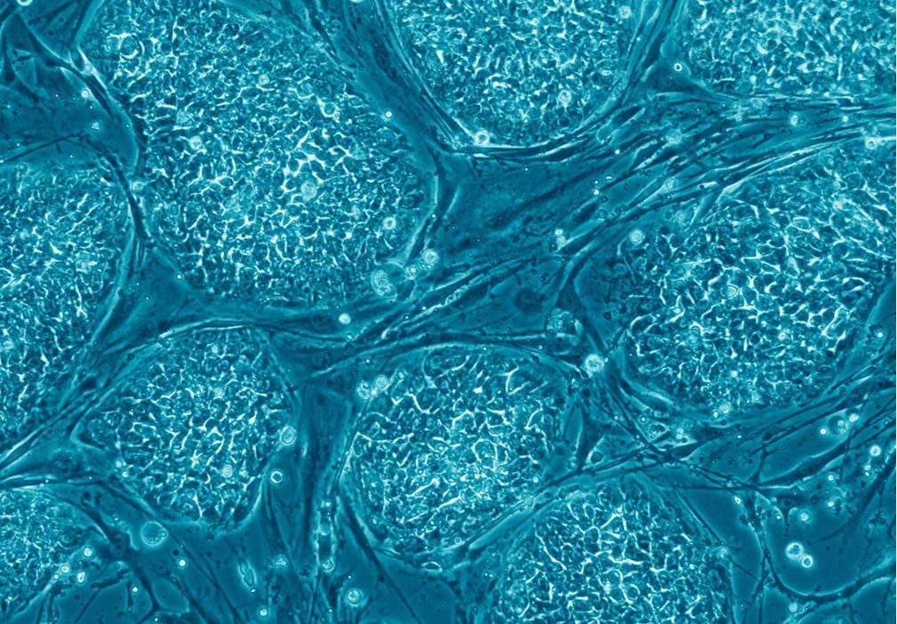 Les cellules souches, comme ces cellules souches embryonnaires, ont la propriété de se différencier en n'importe quel tissu. Encore faut-il leur donner la bonne recette ! © Eugene Russo, Plos One, cc by 2.5