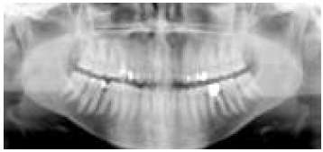 Panoramique dentaire : 1 jour d’irradiation naturelle © SFRP