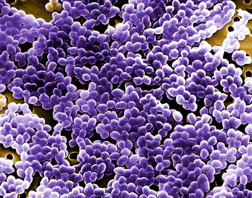 Enterococcus faecalis fait concurrence aux enzymes humaines pour convertir la L-dopa en dopamine. © Janice Haney Carr, USCDCP, Pixnio