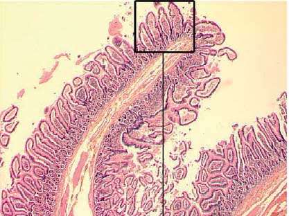 Coupe anatomorphologique de tissu intestinal humain © Curie