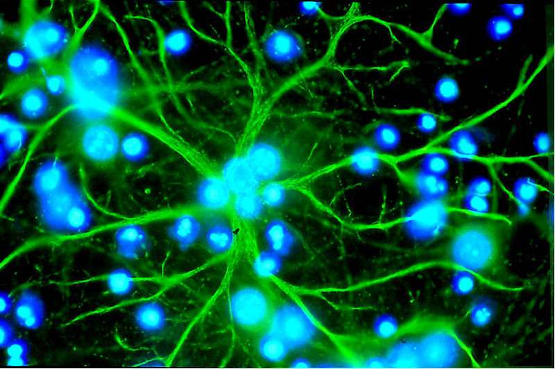 Un astrocyte (en vert) possède une forme caractéristique en étoile. Ses digitations le connectent à de nombreux neurones simultanément, lui permettant d'intervenir sur un grand nombre de connexions à la fois. © Karin Pierre, Alliance européenne Dana pour le cerveau (EDAB).