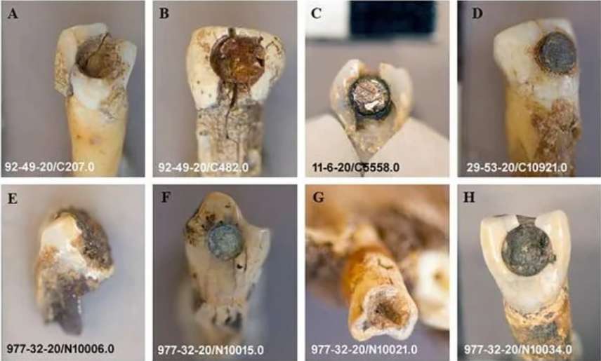 Les huit dents analysées ont été retrouvées sur trois sites archéologiques différents : au Honduras, au Guatemala et au Belize. © Hernández-Bolio et al., Journal of Archaeological Science, 2022