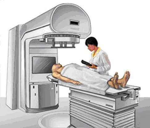 La radiothérapie est l'un des traitements possibles contre le cancer. © Institut national du cancer du Canada
