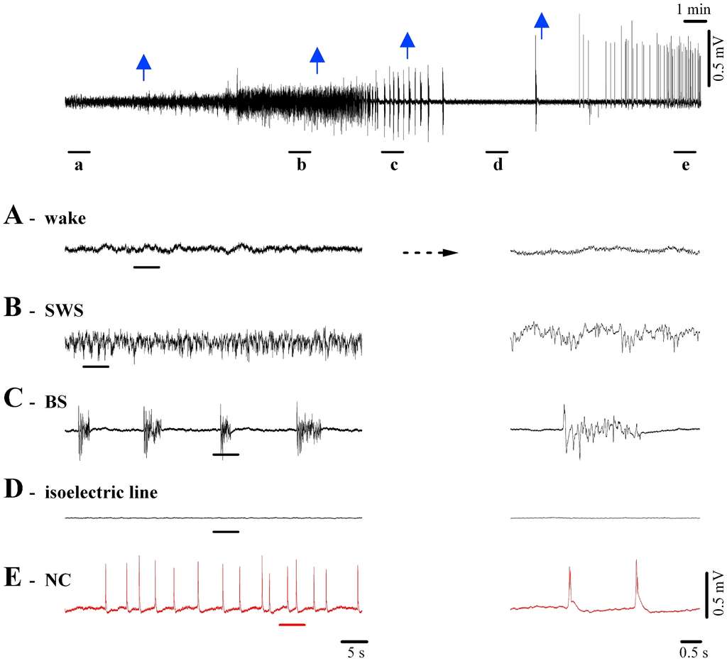 Ces graphiques montrent l'évolution des tracés encéphalographiques des chats au cours du temps. En A, ils sont éveillés. En B et C, ils plongent dans un coma de plus en plus profond, l'activité électrique du cerveau diminuant fortement. En D, on obtient quasiment une ligne isoélectrique. Mais en E, alors que les doses d'anesthésiques sont plus importantes (les flèches bleues indiquant les injections), on retrouve une activité cérébrale marquée au niveau de l'hippocampe et qui se propage jusqu'au cortex. Ce sont les complexes nu. © D. Kroeger et al., Plos One, cc by 2.5