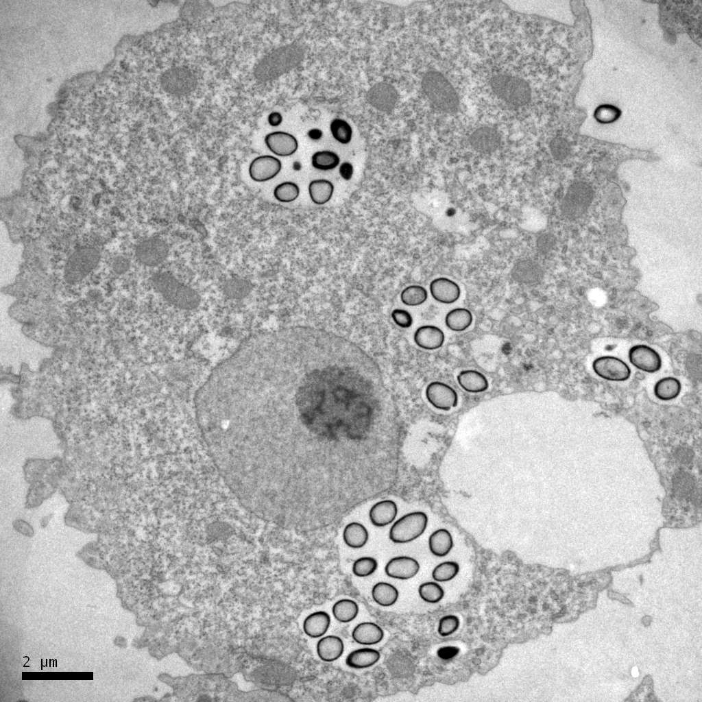 À l'image, on peut voir une amibe infestée par des pandoravirus (ronds grisés cerclés de noir). Ceux-ci, longs d'environ 1 µm, sont mortels pour cet unicellulaire. © Chantal Abergel, Jean-Michel Claverie
