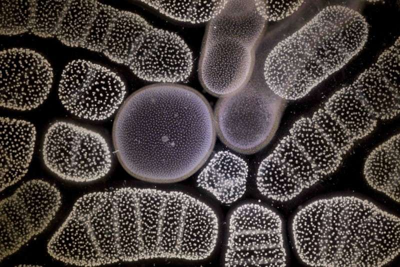 Colonies de radiolaires Collozum : au stade colonial ce radiolaire est formé de l’agrégation de milliers de cellules individuelles qui se sont divisées (les points blancs). Les cellules produisent et vivent dans une gangue gélatineuse commune formant des sphères ou boudins longs de quelques centimètres. Leur teinte plus ou moins brune correspond à leur cycle de vie et à l’abondance d’algues symbiotiques (les petits points ocre). © C. Sardet CNRS